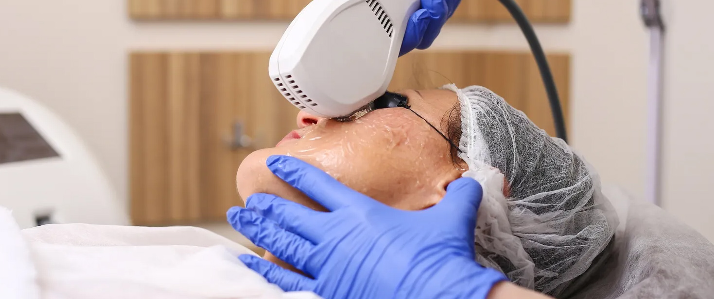 OptiLight by Lumenis in Santa Clara, CA eyeXam Optometry