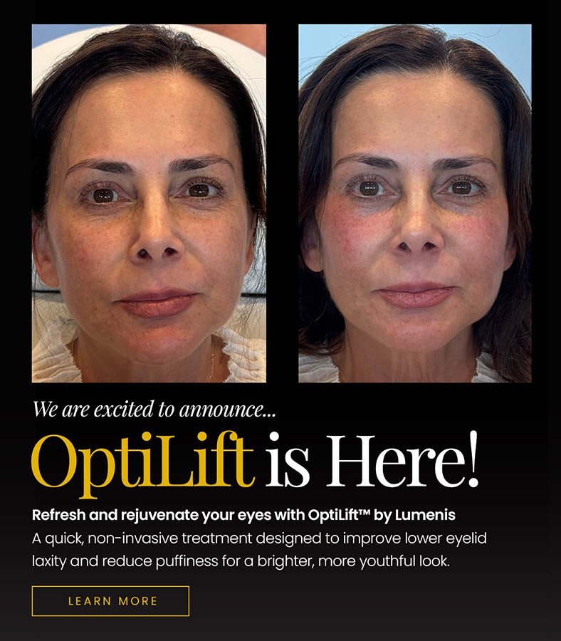 optilift2